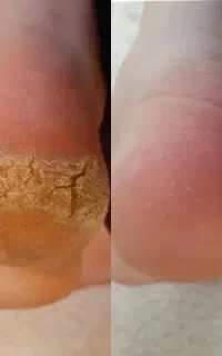 پدیکور پا