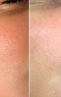 فیشال تخصصی بقیمت مواد