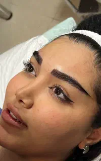 کاشت تخصصی ابرو و مو