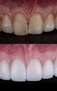 خدمات دندانپزشکی با شرایط ویژه