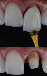 خدمات دندانپزشکی با تعرفه دولتی (مطالعه شود)