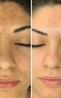 پکیج زیبایی بیوممتیک