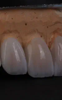 پرسلن گذار ماهر-کاراموز قالب ریزی