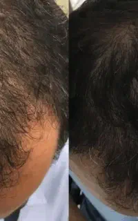 واقعی درمانت میکنم