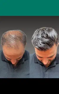 تار هاتو افزایش بده