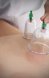 حجامت و بادکش(سیار)