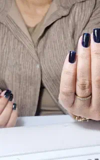 تخفیف ویژه کاشت ناخن