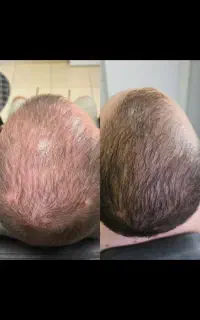 از یدونه تار مو هم نگذره