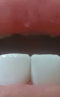رشتی های عزیز کامپوزیت بدون پیش پرداخت