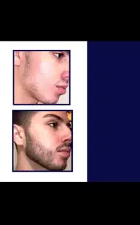 موهاتو زیباکن