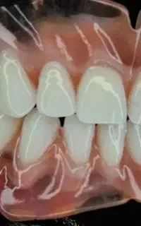 دندانسازی آرین ازکات