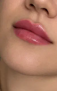تزریق و آموزش بوتاکس و فیلر و پرسینگ و مزو و غیره