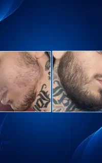 نرم و پرپشت میشه ریشات