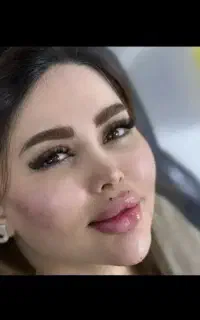 مادلینگ عربی، ترکی، ژل، بوتاکس، فیلر بادی زاویه