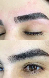 اصلاح تخصصی صورت و ابرو