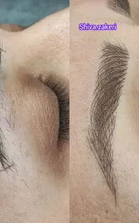تخفیف ویژه  میکروبلدینگ وشیدینگ