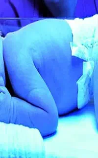 دستگاه زردی با تخفیف ویژه ۳۰درصدی و ارسال رایگان