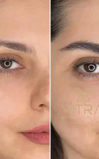 آموزش‌میکروبلیدینگ ابرو‌‌شیدینگ‌لب/خط‌چشممیکروابرو