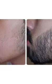 ریش و مو پرپشت و ضخیم