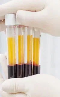 پی آر پی،فقط ۸۹۰