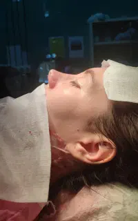 با۲۴تومن عمل زیبایی بینی کن جمعه