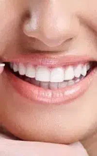 انجام کلیه خدمات دندان پزشکی
