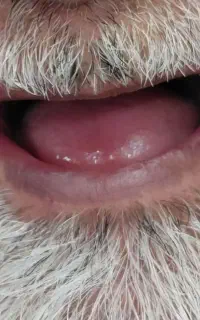 سلامت و زیبایی دندان