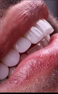 کامپوزیت دندان و خدمات درمانی دندان