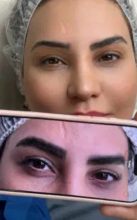 ریموو ابرو،خط لب،خط چشم در ۱الی۲جلسه در شیراز زرهی