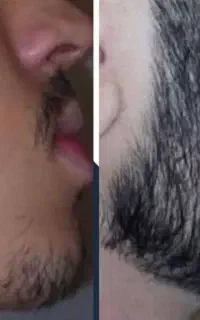 کاشت ممنوع