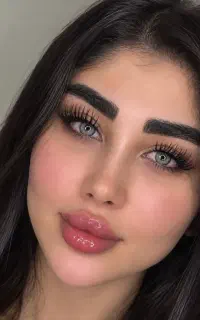 تخفیف 30%خدمات ژل بوتاکس فیلر پی آر پی مزو لیزر