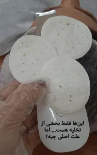 فیشال (پاکسازی پوست)فاطیما