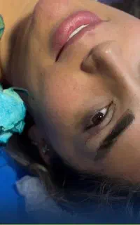 جشنواره بلفاروپلاستی،ساکشن غبغب،بوکال،سانترال لب