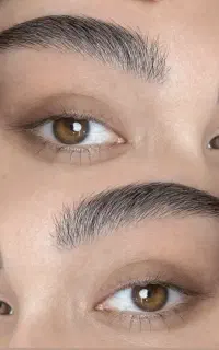 مرکزتخصصی ریمووتتو'میکروابرو