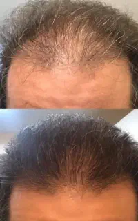 از جمع کچل ها بیا بیرون