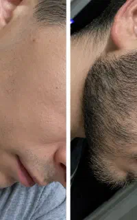 دیگه نیازی به کاشت نیست