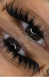 کاشت موقت مژه عدالت 36