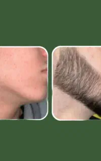 شگفت انگیز