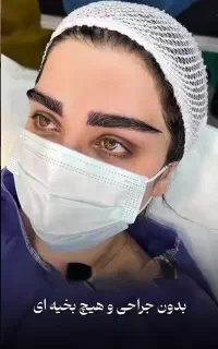 کاشت ابرو تضمینی ۱۲۹۰۰ بلفاروپلاستی توسط پزشک ۸۹۰۰
