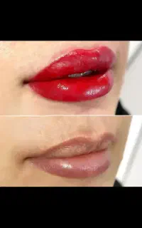 آرایش دائم و ریموو برکه