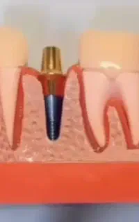 خدمات دندانپزشکی اقساط چک