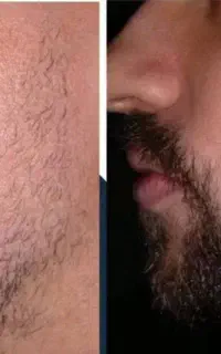 بمب پرپشتی