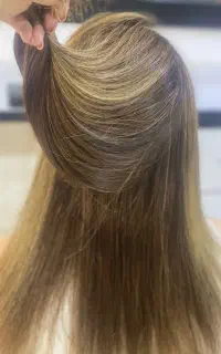 تراپی سرد از ۱/۵۰۰
