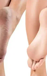 کرم  مراقبت پا