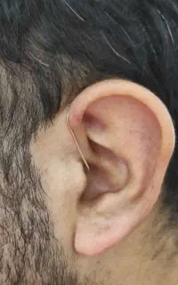 کلینیک شنوایی وسمعک