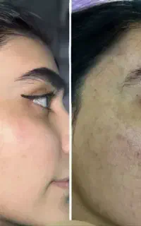 اقتصادی ترین ضد‌لک جهان بیوممتیک