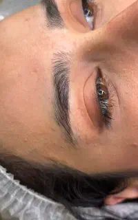 میکروبلیدینگ به سبک نچرال فیبروز