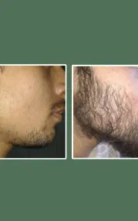 تغذیه‌کننده ریش