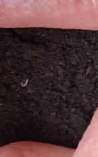 کود حیوان  پهن الگ زده