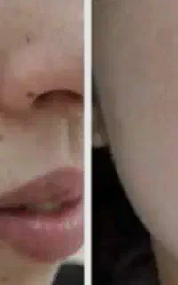 خال برداری